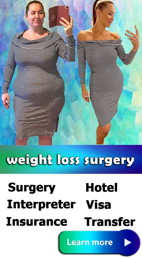weight loss surgery iran surgery center