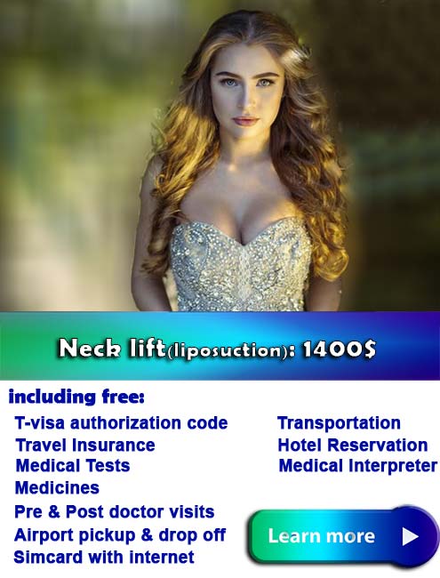 Neck Lift & Neck Liposuction