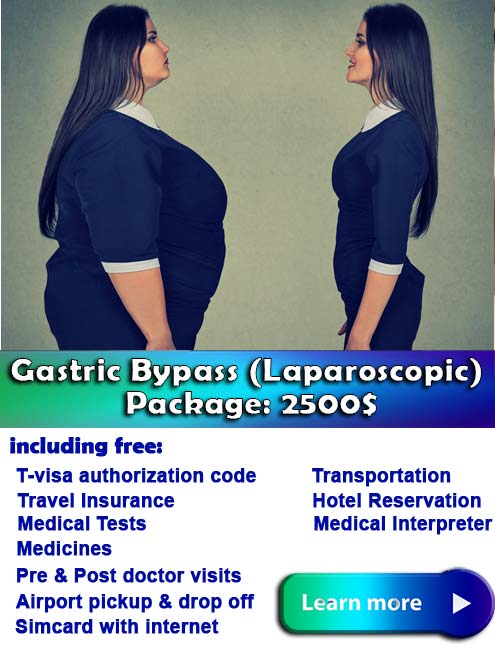 laparoscopic Gastric bypass Iran