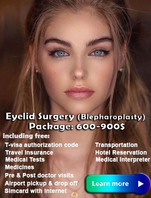 Eyelid surgery iran