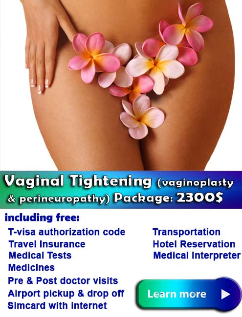 vaginal tightening cost iran