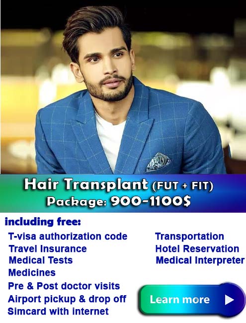 hair transplant cost in iran