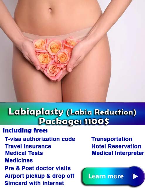 Labiaplasty Procedure