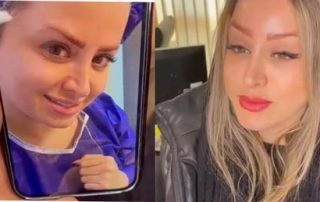 browlift surgery Iran