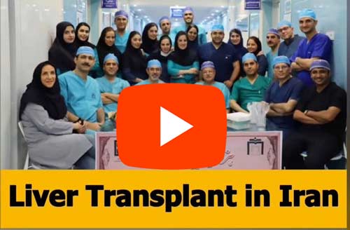 liver transplant in Iran